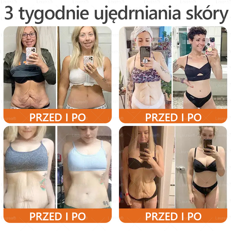 ✨✨✨✨Leurea® Krem Regenerujący z Jadem Pszczelim🔥 Naturalna regeneracja skóry, wygładzenie zmarszczek i promienna cera-50 ml