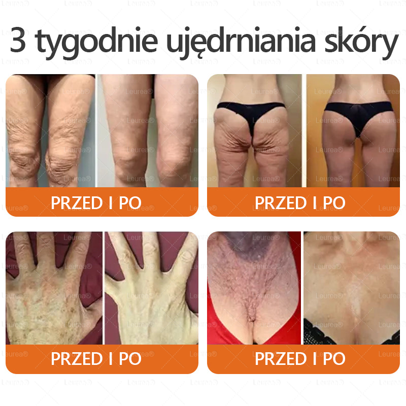 ✨✨✨✨Leurea® Krem Regenerujący z Jadem Pszczelim🔥 Naturalna regeneracja skóry, wygładzenie zmarszczek i promienna cera-50 ml