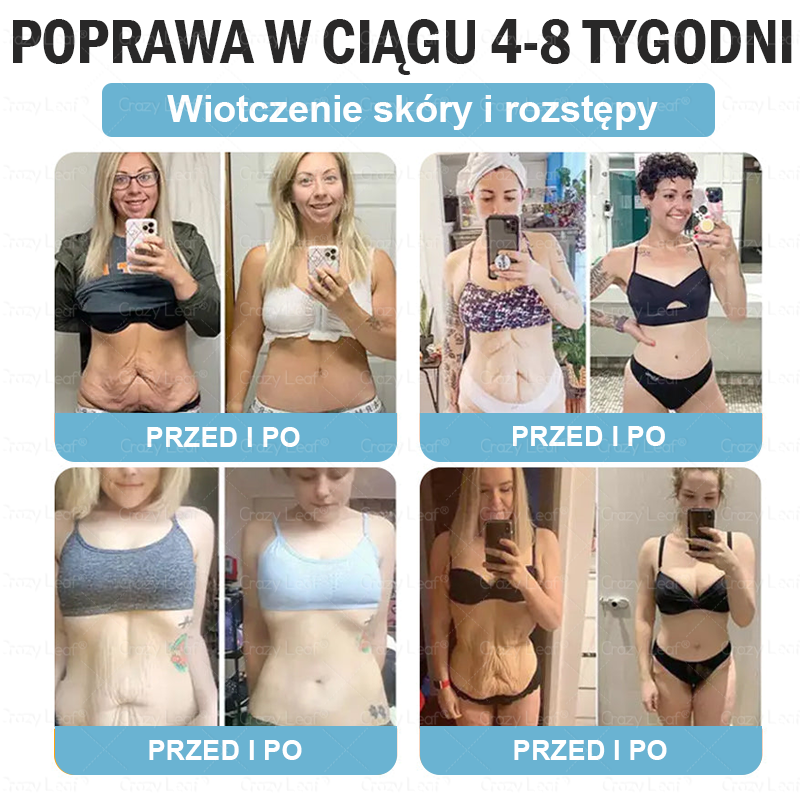 🔥 Polska – Klinicznie potwierdzone | Oficjalny sklep | CrazyLeaf® Slim & Vitality Tirzepatide – doustny roztwór wspierający odchudzanie, ciśnienie i poziom cukru