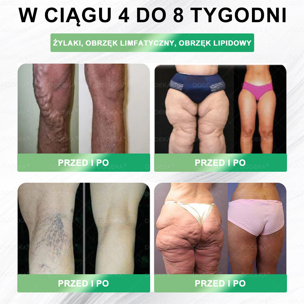 🌿🌿🌿DOOEKA® GLP-1 8 w 1 Fit & Vital roztwór doustny – Raz dziennie, widoczne zmiany w ciągu 7 dni / W przypadku otyłości, zdrowia serca i układu krążenia, cukrzycy, bezdechu sennego, zdrowia jelit, problemów ze stawami i wielu innych