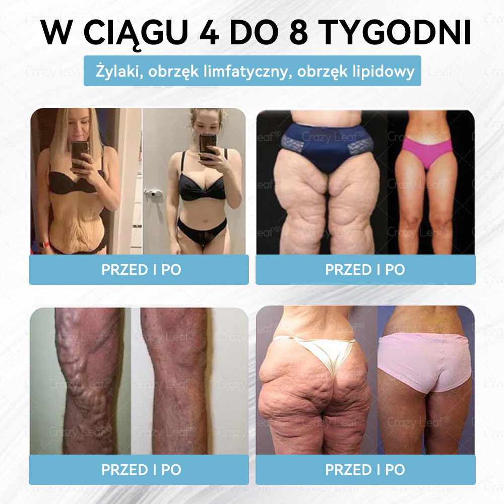 🔥 Polska – Klinicznie potwierdzone | Oficjalny sklep | CrazyLeaf® Slim & Vitality Tirzepatide – doustny roztwór wspierający odchudzanie, ciśnienie i poziom cukru
